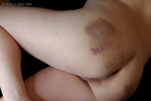 birthdaybruisewm