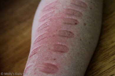 Marks on Molly's skin left by her Dom