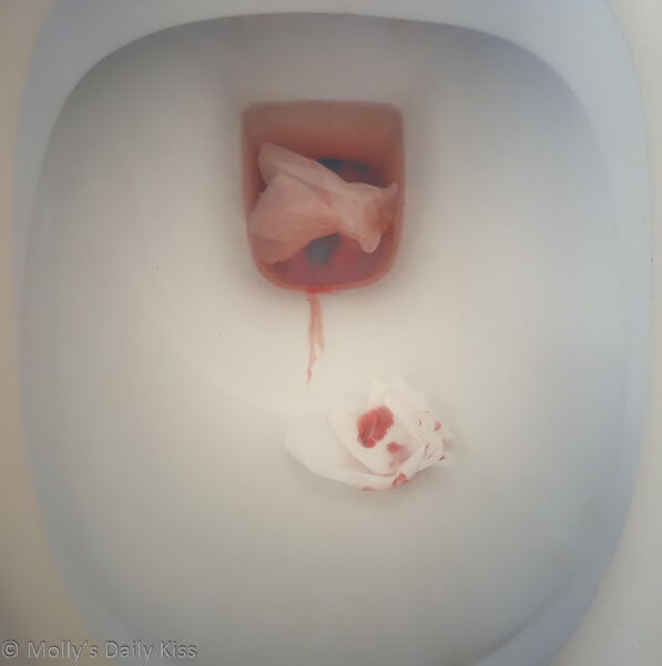 Period blood in toilet
